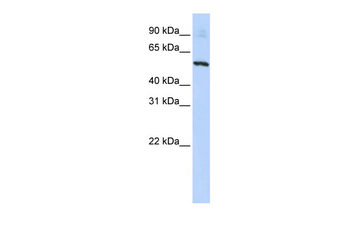 SLC36A2 Rabbit Polyclonal Antibody