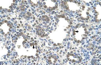 SLC26A5 Rabbit Polyclonal Antibody