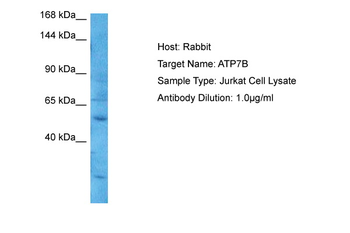 ATP7A Rabbit Polyclonal Antibody