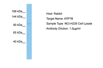 ATP7A Rabbit Polyclonal Antibody