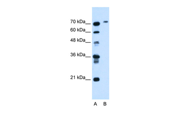 BCHE Rabbit Polyclonal Antibody