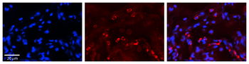 GAA Rabbit Polyclonal Antibody