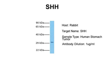 SHH Rabbit Polyclonal Antibody