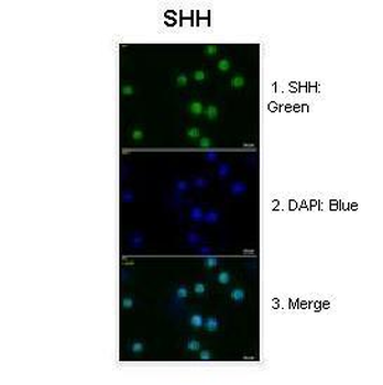 SHH Rabbit Polyclonal Antibody
