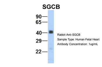SGCB Rabbit Polyclonal Antibody
