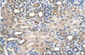 HFE Rabbit Polyclonal Antibody