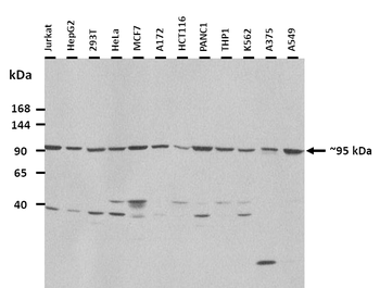 LDLR Rabbit Polyclonal Antibody