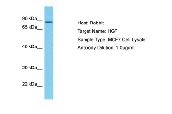 HGF Rabbit Polyclonal Antibody