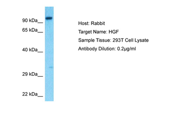 HGF Rabbit Polyclonal Antibody
