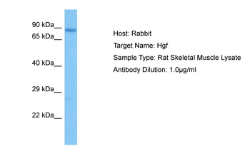 HGF Rabbit Polyclonal Antibody