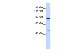PDE3B Rabbit Polyclonal Antibody