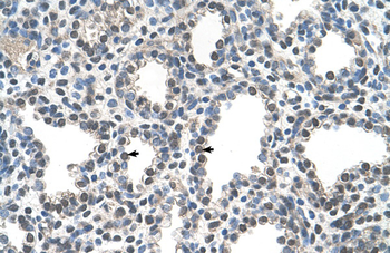 PPIB Rabbit Polyclonal Antibody