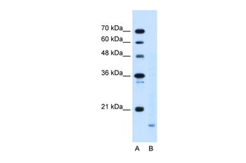 PPIB Rabbit Polyclonal Antibody
