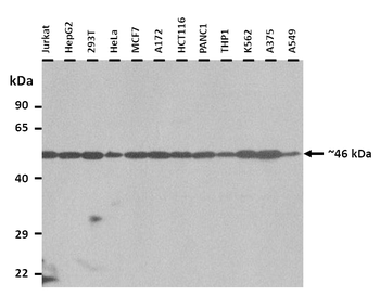 ZFYVE27 Rabbit Polyclonal Antibody