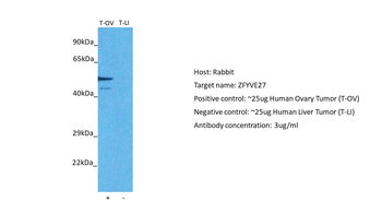 ZFYVE27 Rabbit Polyclonal Antibody
