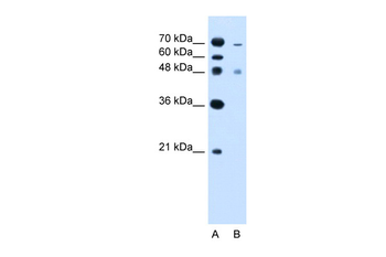 ZFYVE27 Rabbit Polyclonal Antibody