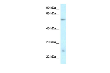 DERL3 Rabbit Polyclonal Antibody