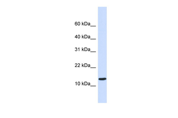 STUM Rabbit Polyclonal Antibody