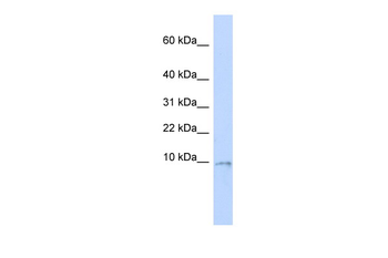 UCRC Rabbit Polyclonal Antibody