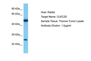 CLEC2D Rabbit Polyclonal Antibody