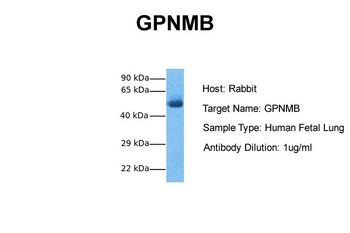 GPNMB Rabbit Polyclonal Antibody