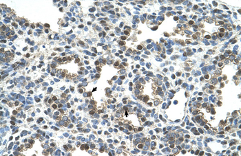 GPNMB Rabbit Polyclonal Antibody