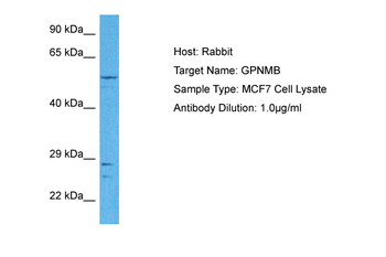 GPNMB Rabbit Polyclonal Antibody