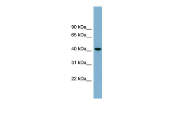B4GALT2 Rabbit Polyclonal Antibody