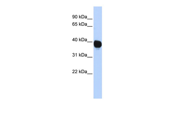 TPST2 Rabbit Polyclonal Antibody