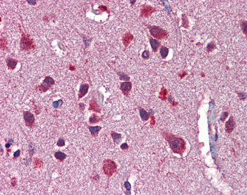 NRG3 Rabbit Polyclonal Antibody
