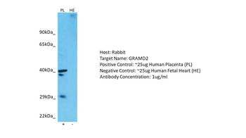 GRAMD2A Rabbit Polyclonal Antibody