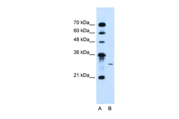 AGPAT2 Rabbit Polyclonal Antibody