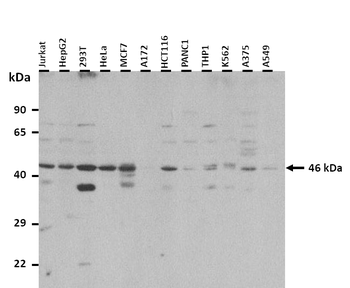 IGSF11 Rabbit Polyclonal Antibody
