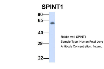 SPINT1 Rabbit Polyclonal Antibody