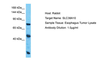 SLC38A10 Rabbit Polyclonal Antibody