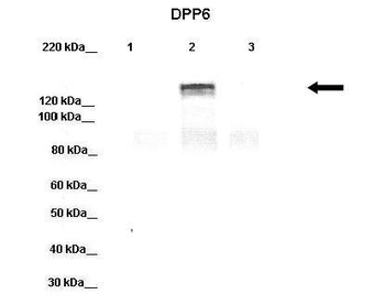 DPP6 Rabbit Polyclonal Antibody