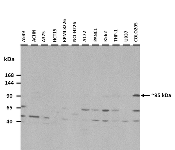 ENPP2 Rabbit Polyclonal Antibody