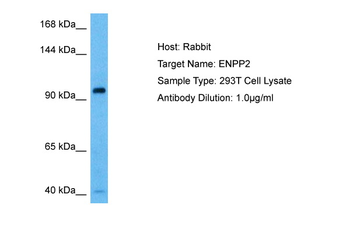 ENPP2 Rabbit Polyclonal Antibody