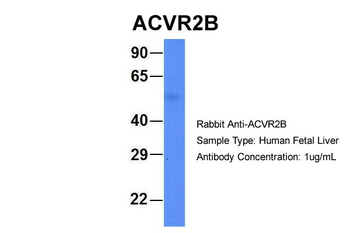 ACVR2B Rabbit Polyclonal Antibody