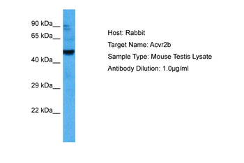 ACVR2B Rabbit Polyclonal Antibody
