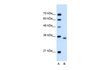 ACVR2B Rabbit Polyclonal Antibody