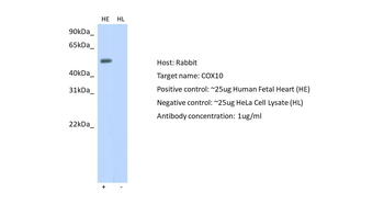 COX10 Rabbit Polyclonal Antibody