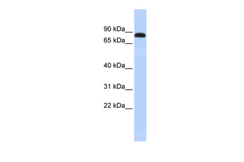 DSC3 Rabbit Polyclonal Antibody