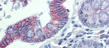 DSG2 Rabbit Polyclonal Antibody