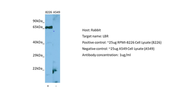 LBR Rabbit Polyclonal Antibody