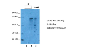 LBR Rabbit Polyclonal Antibody