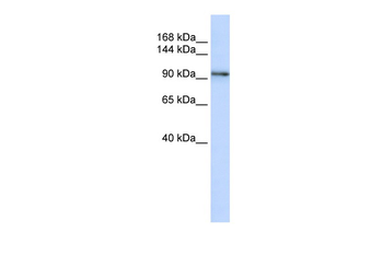 PCDH1 Rabbit Polyclonal Antibody