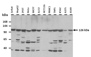 PPP1R3A Rabbit Polyclonal Antibody
