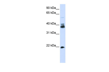 SYP Rabbit Polyclonal Antibody
