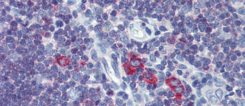 TFR2 Rabbit Polyclonal Antibody